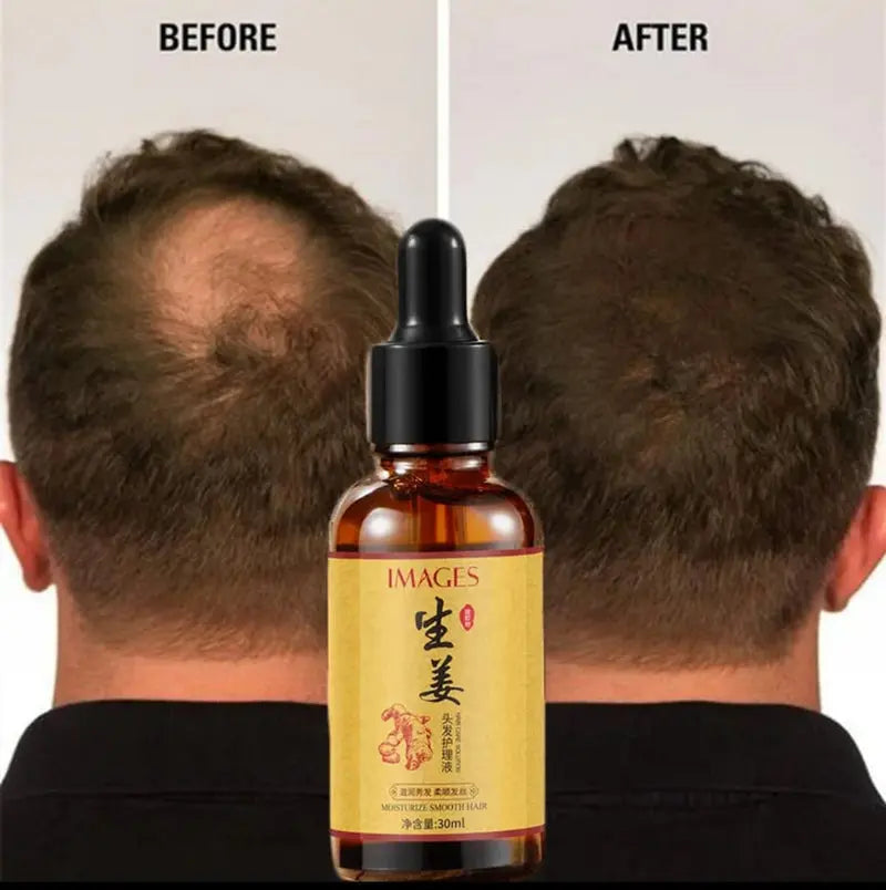 Images hair Growth ginger serum Cosmia